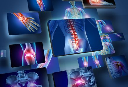 Vacancy: Musculoskeletal Conditions (Rheumatology) Clinical Lead